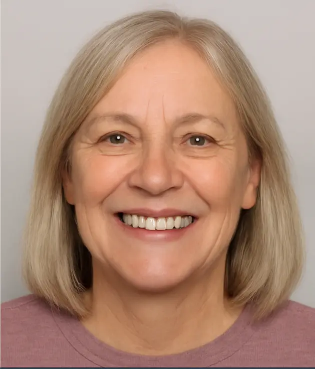 Después de la Ortodoncia